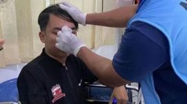 Usai dipukuli orang tak dikenal, MO Madura united dirawat dengan luka memar di pipi 