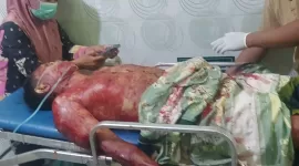 Asmoni, Korban pembacokan mengalami luka parah di bagian leher dan sempat dilarikan ke rumah sakit.