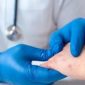 Gejala cacar monyet biasanya muncul 2-4 minggu setelah terpapar virus.
